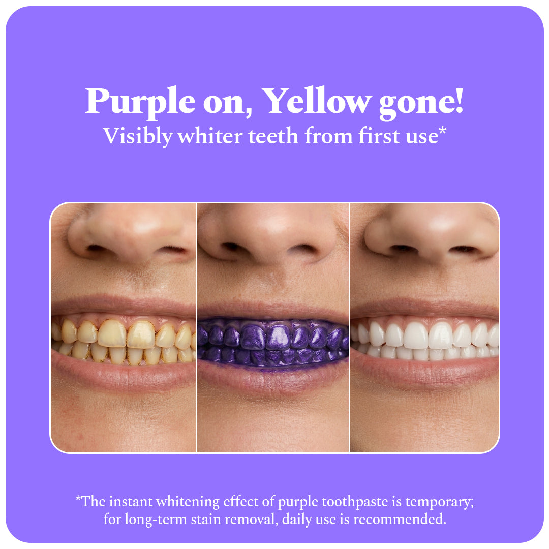 Perfora | Magic Whitening Toothpaste