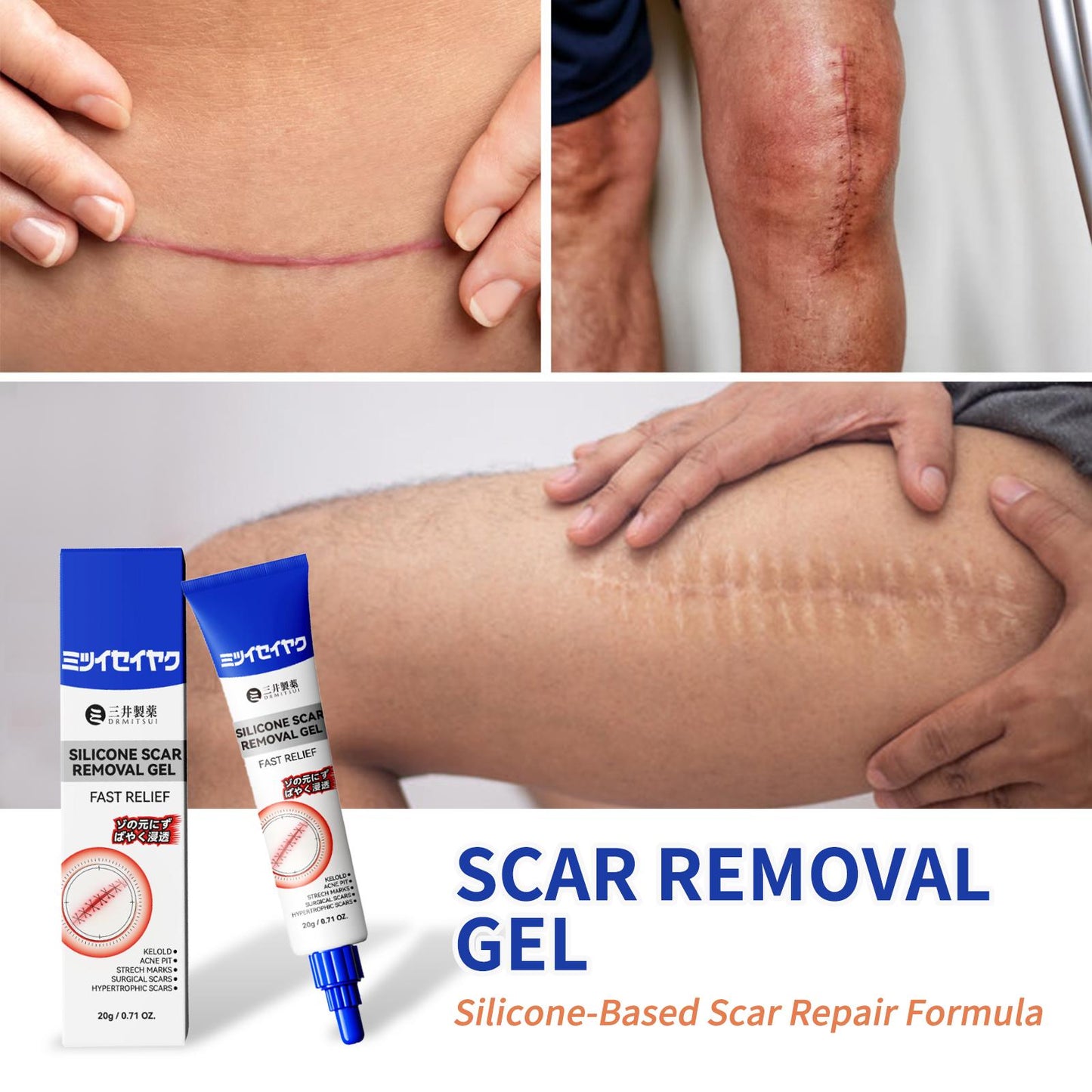 ScarEase Silicone Scar Gel