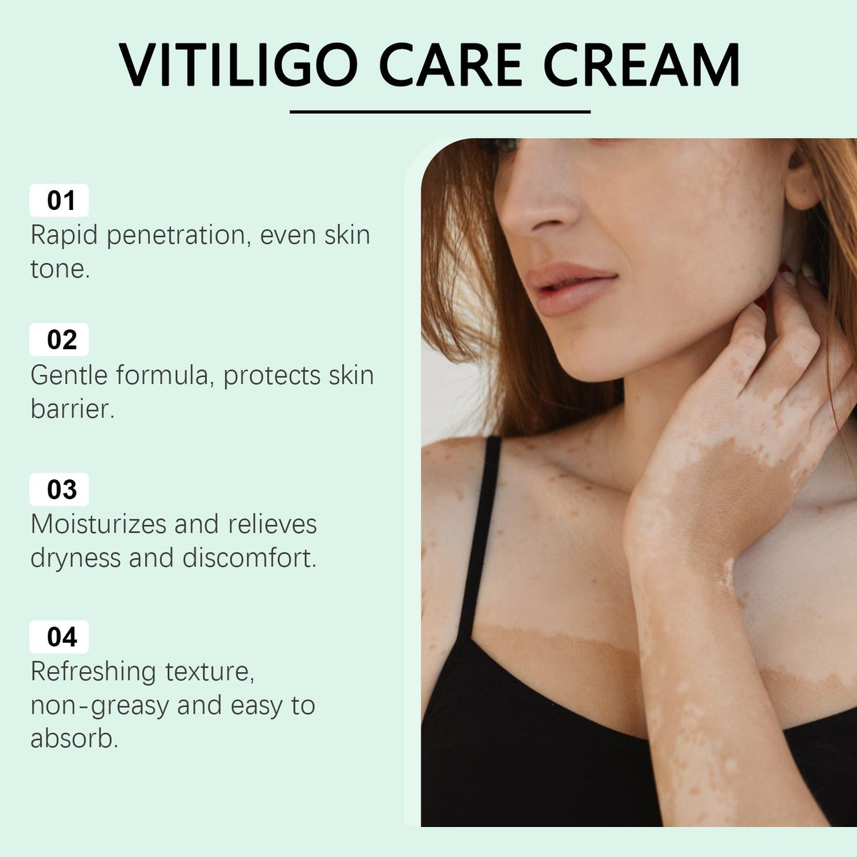 Dermacare Vitiligo Herbal Aloe Vera & Mint Care Cream