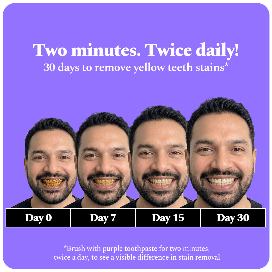 Perfora | Magic Whitening Toothpaste