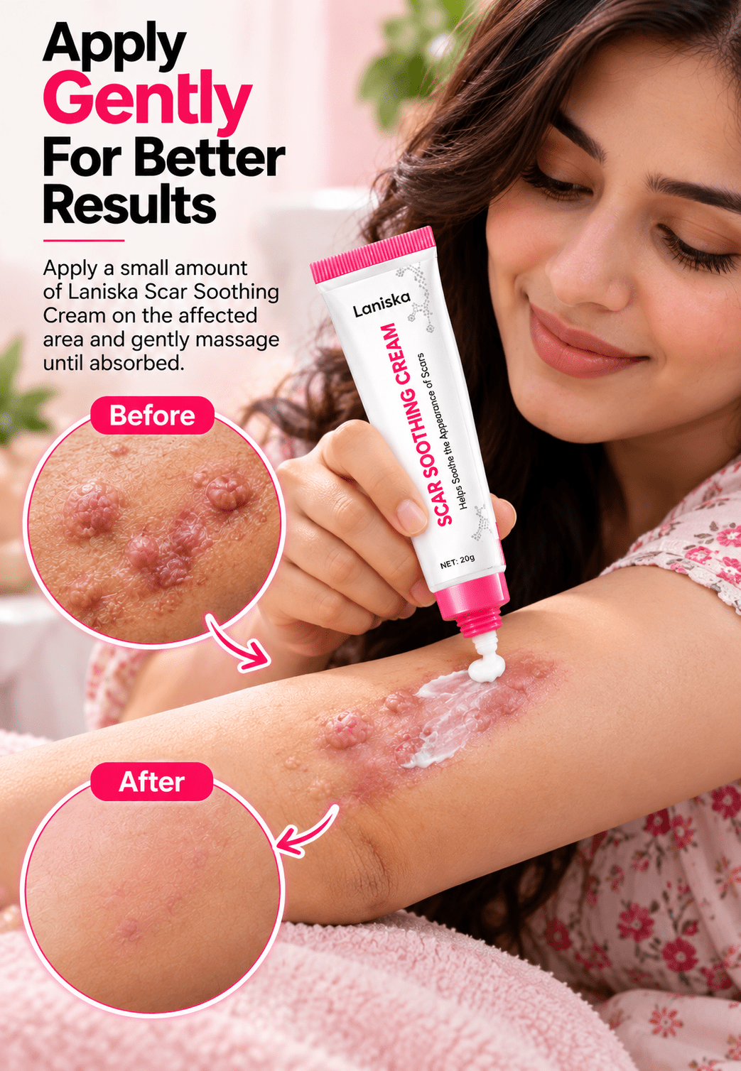 Scar Soothing Cream For Surgical Scars & Skin Repair